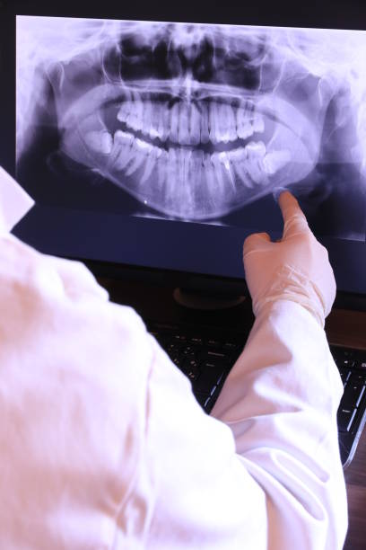 Best Emergency Root Canal Therapy in Glencoe, AL