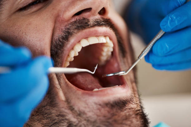 Best Emergency Treatment for Oral Infections in Glencoe, AL